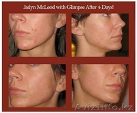 Защитите Организм изнутри соком Ксанго и снаружи косметикой Glimpse!  - Изображение #6, Объявление #140351