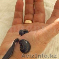 медицинская пиявка - Изображение #2, Объявление #1336585