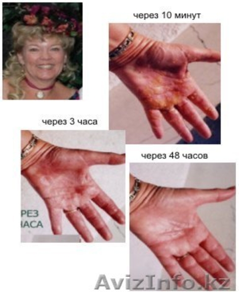 Защитите Организм изнутри соком Ксанго и снаружи косметикой Glimpse!  - Изображение #8, Объявление #140351