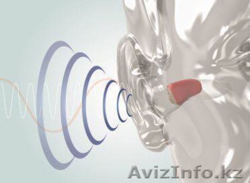 Центр хорошего слуха "Радуга звуков" - Изображение #2, Объявление #902176